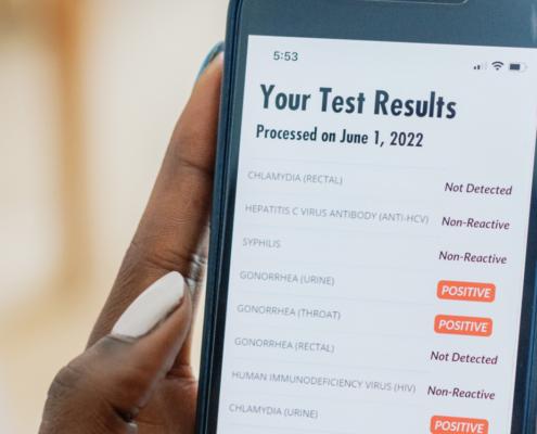 A person receives positive STI results on their phone